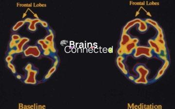 Neuroteología: El Fascinante Encuentro entre el Cerebro y la Religión