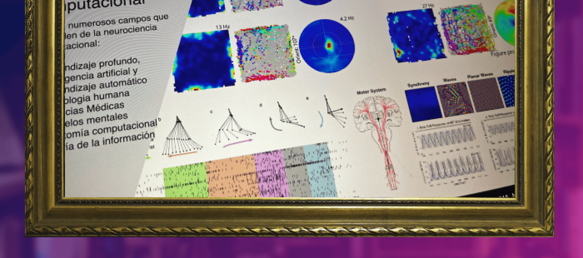 ¿Soñaremos con ovejas eléctricas? Salud aumentada con Neurociencia Computacional